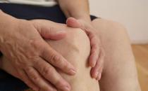 關節炎用藥不慎易高血壓