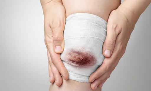 遇到外傷大出血要怎么辦？