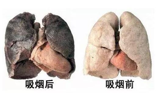 男人近三成癌癥是吸煙惹來的