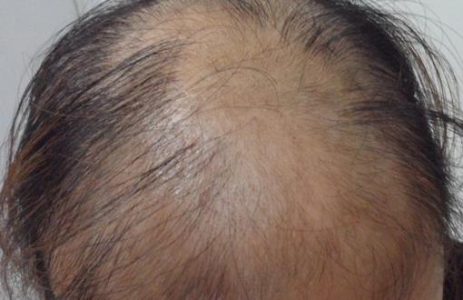 男性養生必知:男人性衰老7大跡象