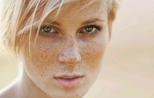 雀斑和吃鹽有關系？雀斑會遺傳嗎？