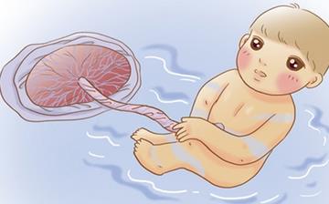 【臍帶】臍帶繞頸_臍帶繞頸能順產(chǎn)嗎_正常臍帶繞頸的調(diào)整方法_臍帶兩周不脫落怎么辦