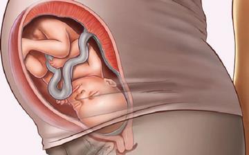 【入盆】入盆后身體會有什么反應_入盆后多久能生_入盆應該注意什么