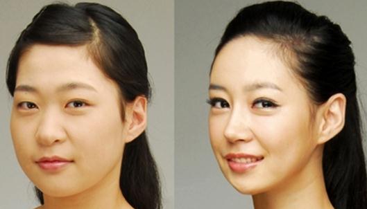 咬肌瘦臉針有什么危害？