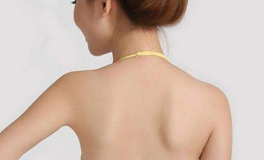 如何檢查是否患有宮頸息肉？