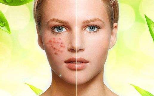 皮膚過(guò)敏干燥脫皮怎么辦呢?