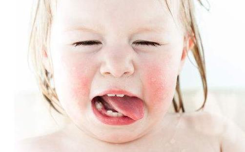 什么是蟯蟲病?蟯蟲的癥狀有哪些