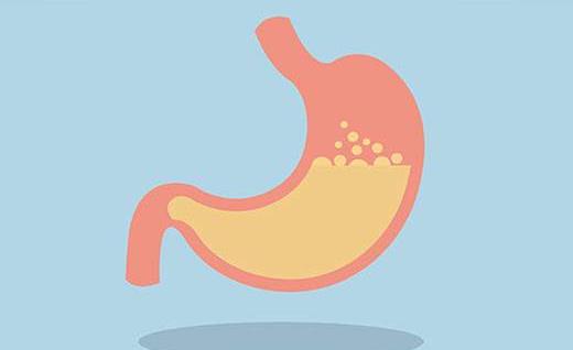 導致胃酸過多的原因有哪些