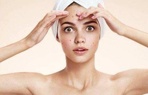 去除色斑需要注意這些誤區