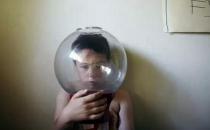 自閉癥與嬰兒大腦發育有關