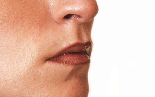 導致流鼻血的原因有哪些