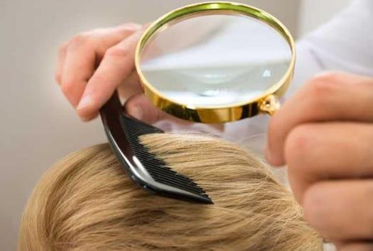 引起脫發(fā)的原因 學(xué)會(huì)這些方法遠(yuǎn)離掉頭發(fā)