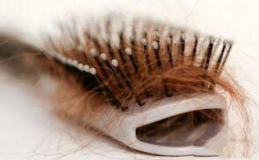 引起脫發(fā)的原因 學(xué)會(huì)這些方法遠(yuǎn)離掉頭發(fā)