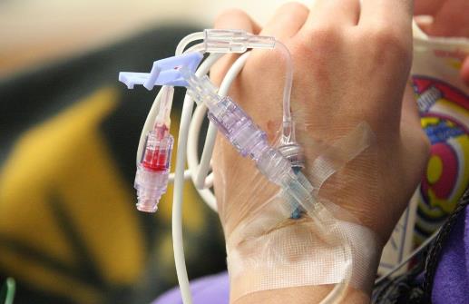 腎病綜合癥名詞解釋 腎病患者一定要把好飲食這一關