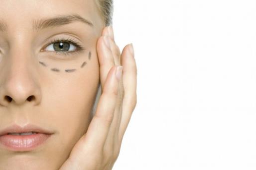 超聲法去眼袋手術(shù)的效果 什么時候做最合適