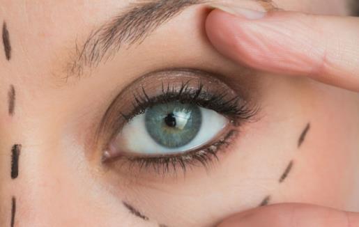 近視眼可以做雙眼皮 高度近視的人最好不做