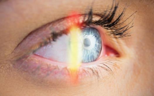 近視眼可以做雙眼皮 高度近視的人最好不做