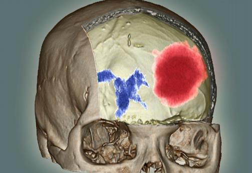 知道牙齒黃黃的原因嗎?真相原來是這樣