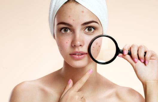 痘痘怎么消除，及時護理是必要的，如果臉上出現痘痘不要