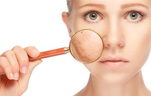 正確護理自己身體 要滋潤這5處不要旱災