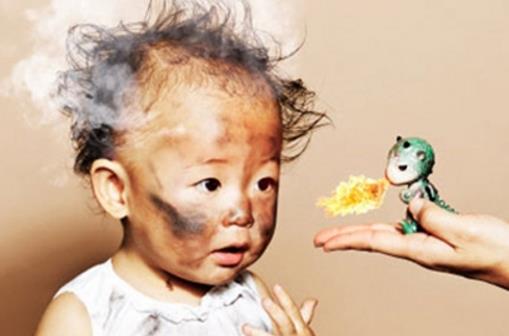 燙傷后護理很重要 水泡要不要挑破