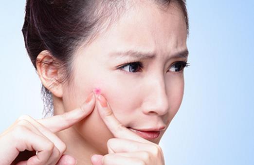 臉長痘痘遲遲不消 小心粉瘤來襲