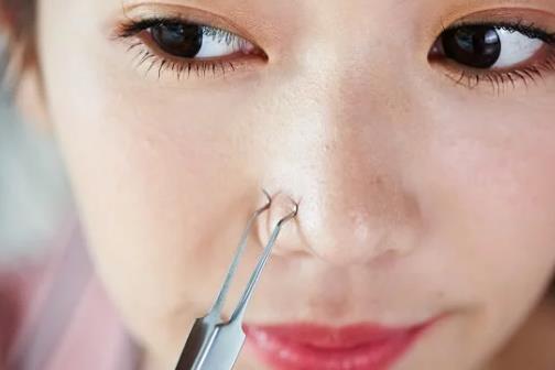 臉長痘痘遲遲不消 小心粉瘤來襲