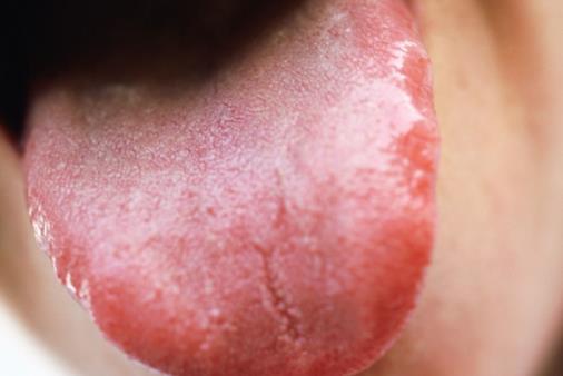 健康保健 從舌苔中便能看出健康