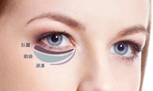 關于去除眼袋的三大誤區 別再做無用功