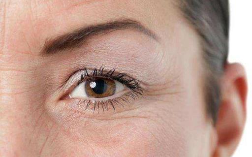 關于去除眼袋的三大誤區 別再做無用功