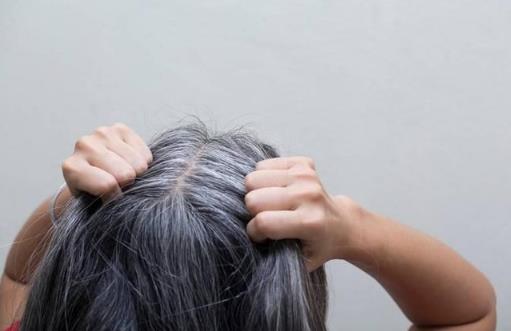 人體已經變白的須發能重新變黑嗎