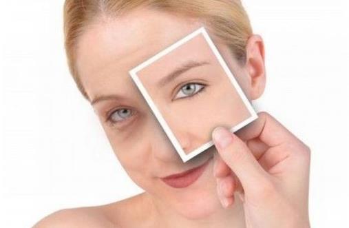 眼睛周圍這些疙瘩是什么？如何消除