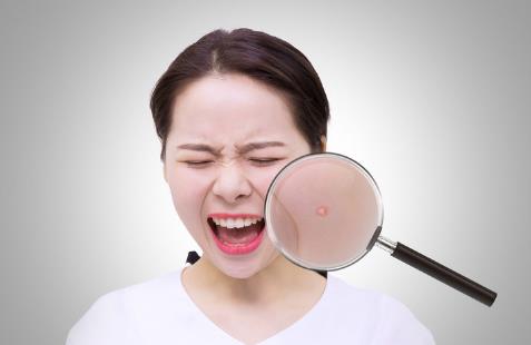 臉長痘痘遲遲不消？小心‘粉瘤’來襲