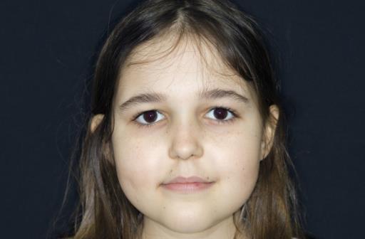 女性容易貧血？日常做到這5點能預防