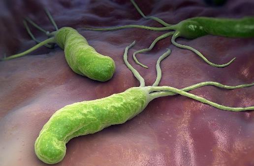 體內有幽門螺桿菌,身體往往有五個標志,占的越多,胃癌