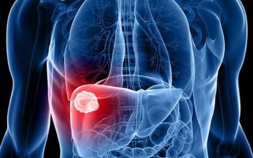 治好脂肪肝從日常做起 脂肪肝減肥要堅持做運動