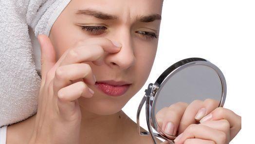 草莓鼻怎么去掉 教你幾招有效祛除黑頭