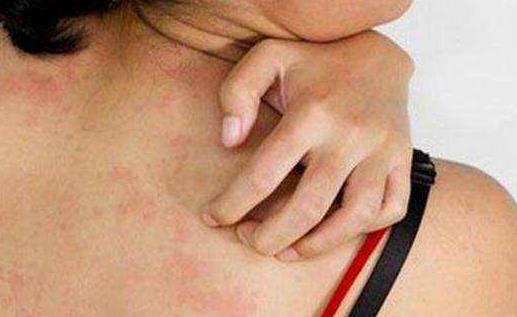 老人皮膚保護能力下降不耐癢 老人皮膚瘙癢的預防