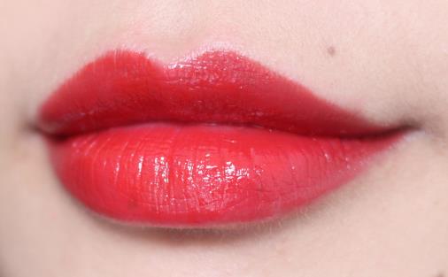 嘟嘟唇術(shù)后注意事項(xiàng)