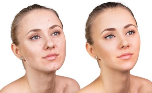 敏感肌如何護膚 溫柔呵護是關鍵