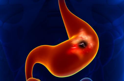 白衣服發(fā)黃怎么辦 去黃只要幾招就夠了