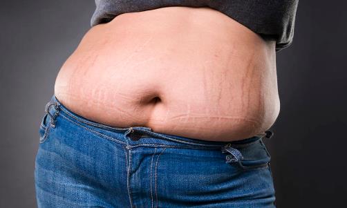 對抗妊娠紋 學會保養和按摩