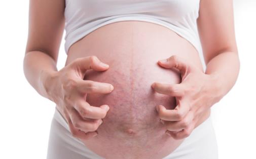 對抗妊娠紋 學會保養和按摩