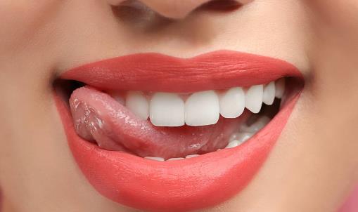 牙齒發黃怎么辦 幾招幫你潔牙美白