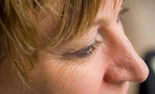 擋不住的魚尾紋幫你有效應對 去魚尾紋的小偏方大全