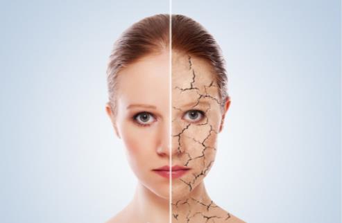 皮膚干燥脫皮怎么辦 4招幫你搞定它