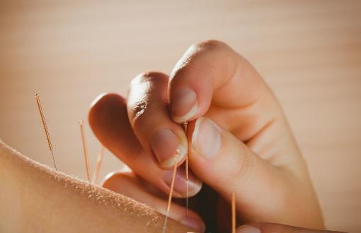 針灸減肥遠離6誤區針灸減肥的穴位常用