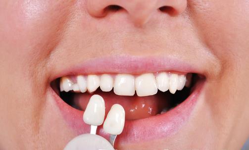 不良智齒應(yīng)及時拔掉 不需要拔智齒的三種情況