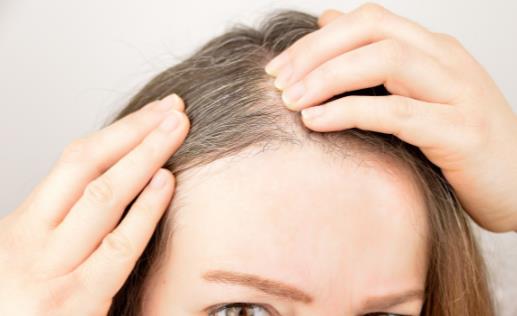 白發生長位置標志著臟腑健康 前額白發多為脾胃失調