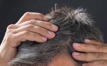 導致頭發變白的壞習慣 小習慣就能擁有一頭烏黑秀發